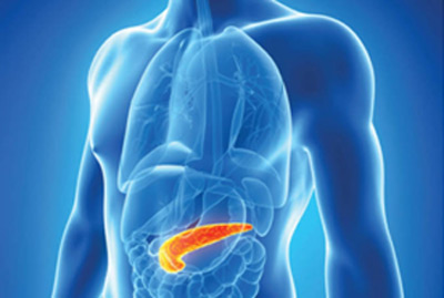 Chronic Pancreatitis