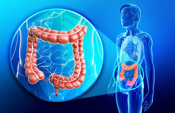 Get Expert Treatment for Colorectal Cancer