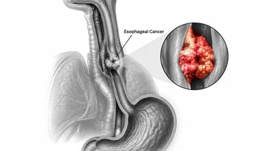 Esophagus (Food Pipe)