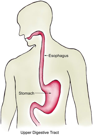 Esophagus Surgery In Delhi