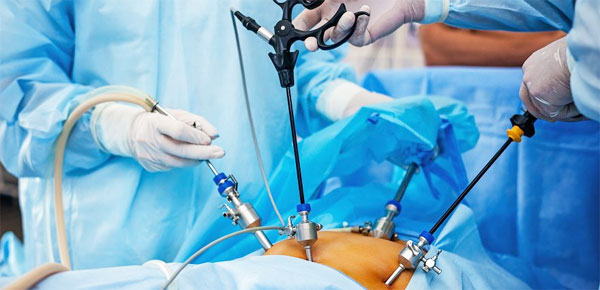Laparoscopic Gastrointestinal Surgery In Delhi
