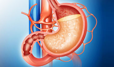 Stomach Cancer Treatment In Delhi