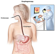 UGI Endoscopy