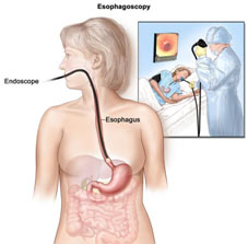 stomach cancer diagnosed